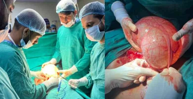 NIIMS Hospital News : “पेट दर्द निकला 3.8 किलो की ओवरी सिस्ट, NIIMS हॉस्पिटल के डॉक्टरों ने रचा नया मेडिकल चमत्कार, 19 वर्षीय युवती की जान बचाकर दिखाया कमाल”, सर्जरी का नेतृत्व कर रहे थे डॉ. हर्ष भाटी, बचाई जान 1 JPEG 20250529 223050 5197717614440120396 converted