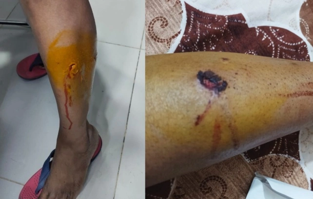 Screenshot 20260319 175339 PicCollage converted