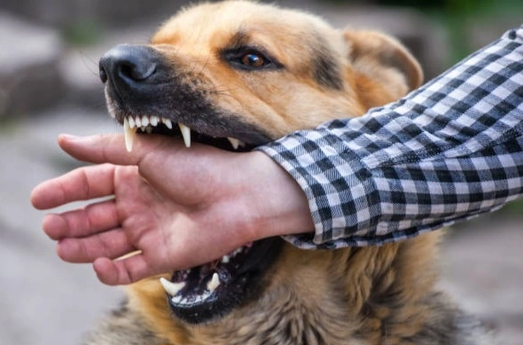 male german shepherd bites a man by the hand converted