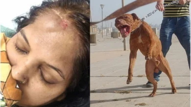 Greater Noida Pitbull Attack : ग्रेटर नोएडा में पिटबुल का खौफ, महिला पर जानलेवा हमला… 15 मिनट तक जबड़े में फंसा रहा हाथ, पार्क में कुत्तों की एंट्री पर लगी रोक, इलाके में दहशत, पार्क में आने से डर रहे लोग, पार्क में कुत्तों की एंट्री पर रोक, उल्लंघन पर लगेगा जुर्माना, प्रशासन से सख्त कार्रवाई की मांग 7 Screenshot 20260803 151653 PicCollage converted
