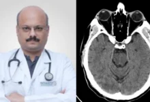 Yatharth Hospital News : यथार्थ अस्पताल में ब्रेन हेमरेज के जटिल मामले का बिना सर्जरी सफल इलाज, समय पर जांच और विशेषज्ञों की टीम ने बचाई मरीज की हालत बिगड़ने से, हर ब्रेन हेमरेज में सर्जरी जरूरी नहीं, डॉक्टरों ने 56 वर्षीय मरीज के ब्रेन हेमरेज के एक जटिल मामले का सफलतापूर्वक उपचार किया 12 Screenshot 20260824 133009 PicCollage converted